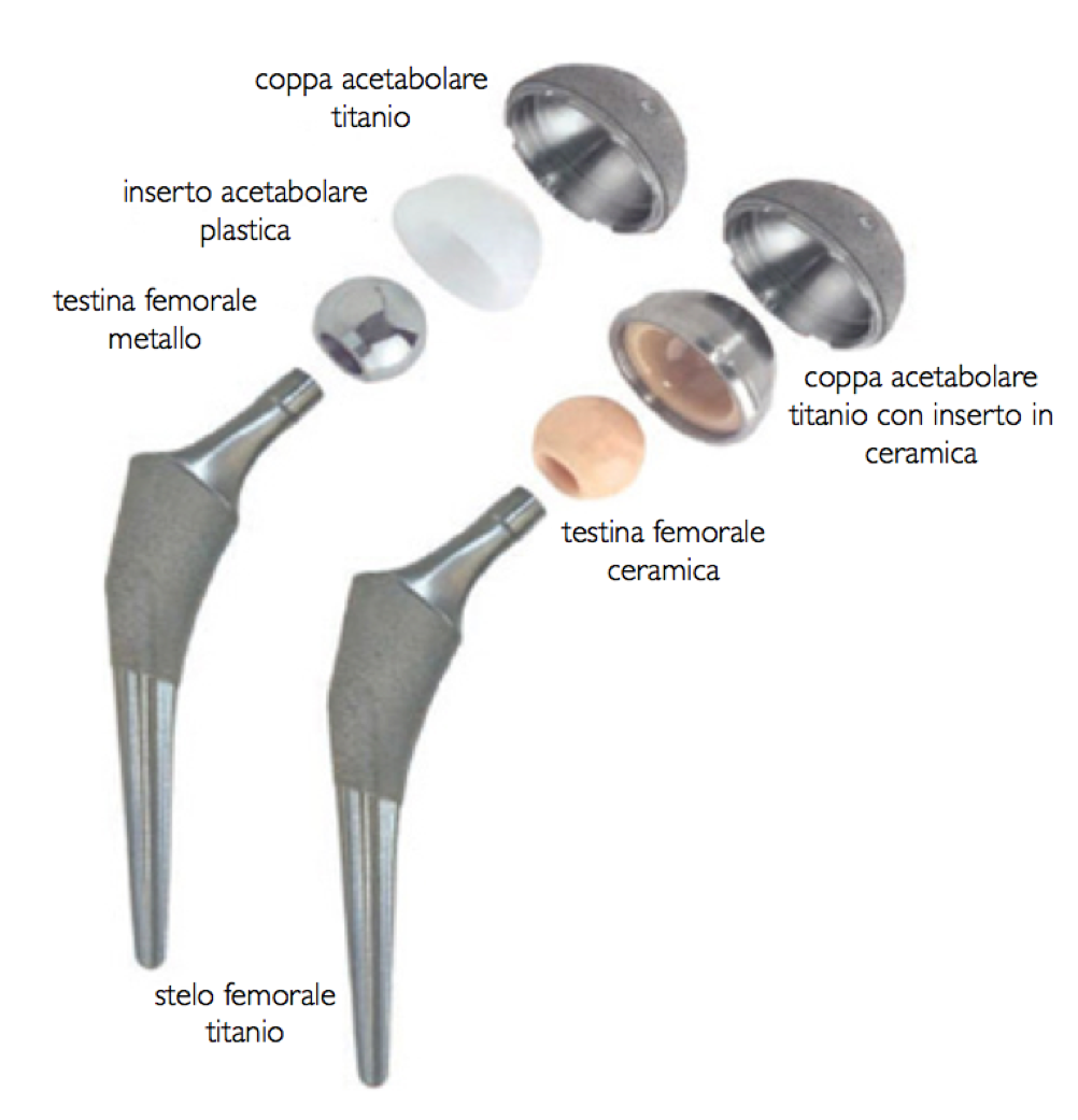 Protesi anca ginocchio chirurgia mininvasiva artrosi Federico Mela ALTA SPECIALITÀ IN CHIRURGIA PROTESICA MININVASIVA DI ANCA E GINOCCHIO _2